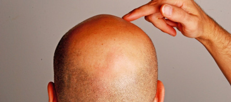 Der tägliche Haarverlust – noch normal oder ein Grund zur Sorge?